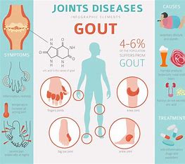 Breaking the Chains: Gout Management and Lifestyle Changes for a Pain-Free Life